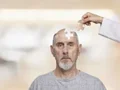 روشهای پیشگیری از آلزایمر: راهکارهای ساده برای کاهش خطر